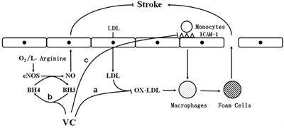 Vitamin C Intake and Ischemic Stroke